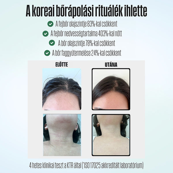 Poseion POSEION BT100 Cap de duș revitalizant coreean premium cu filtru de apă, tehnologie magnetică-ionizantă, gri